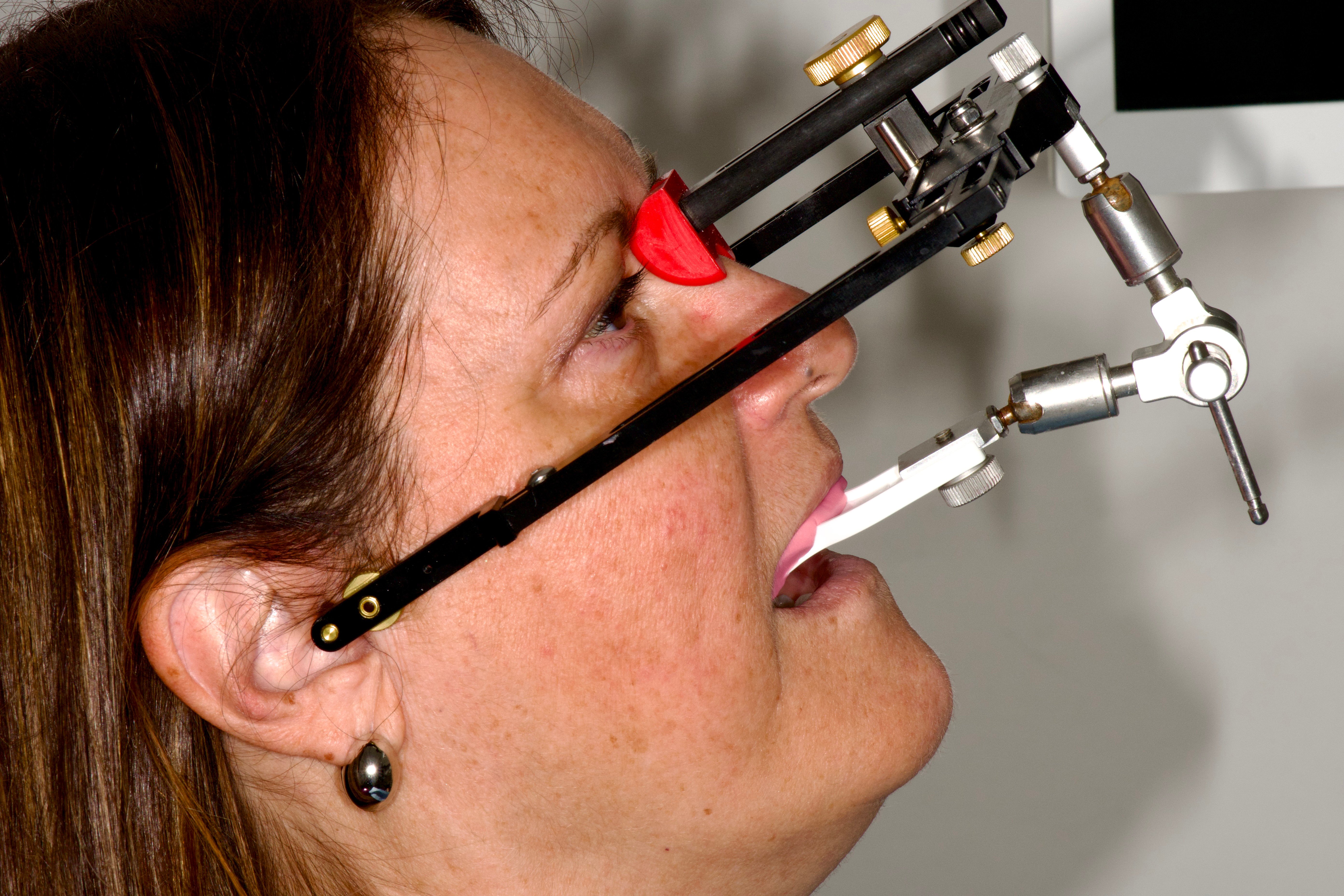 05_Arco_facciale (1)