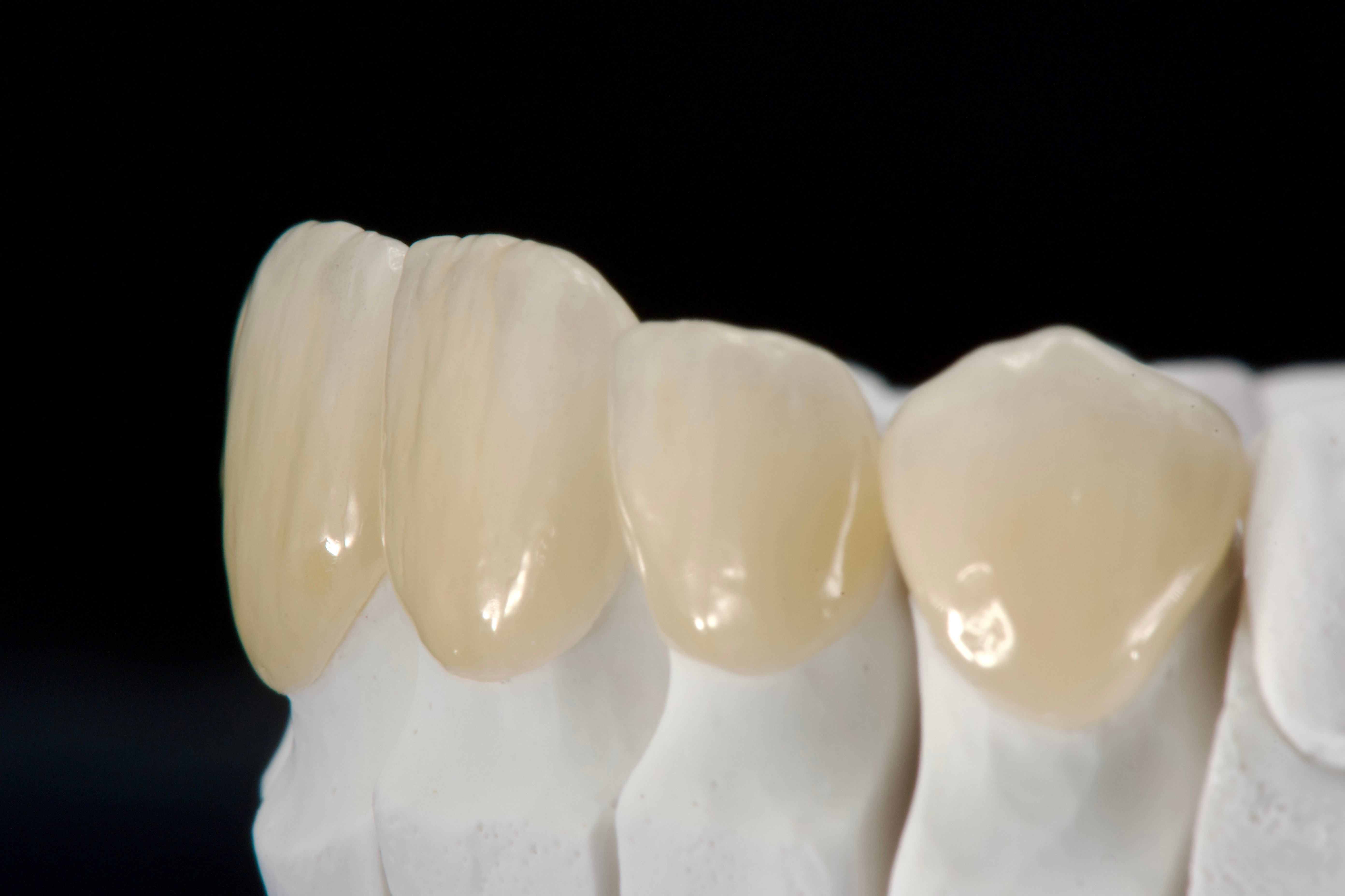 19_glaze_lat (2) (1)