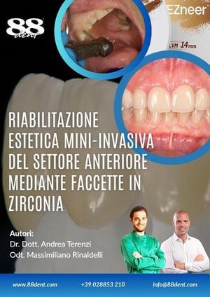 Caso Terenzi Rinaldelli