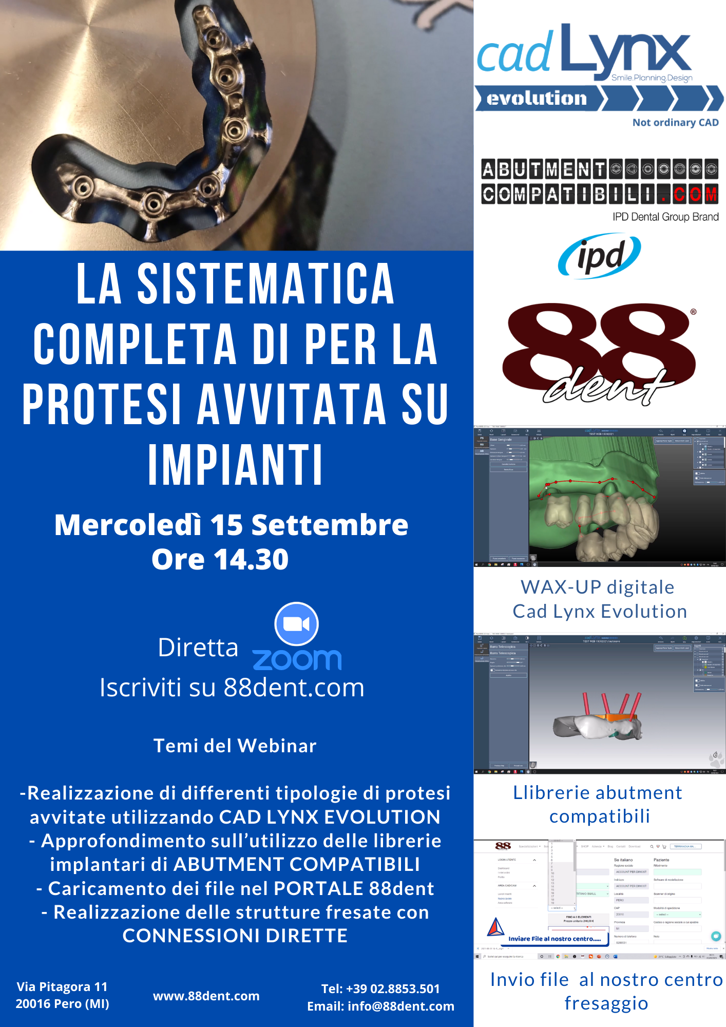 LA SISTEMATICA COMPLETA DI PER LA PROTESI AVVITATA SU IMPIANTI LA SISTEMATICA COMPLETA DI PER LA PROTESI AVVITATA SU IMPIANTI