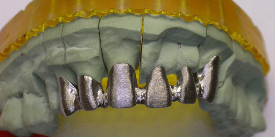 Lega dentale (2)