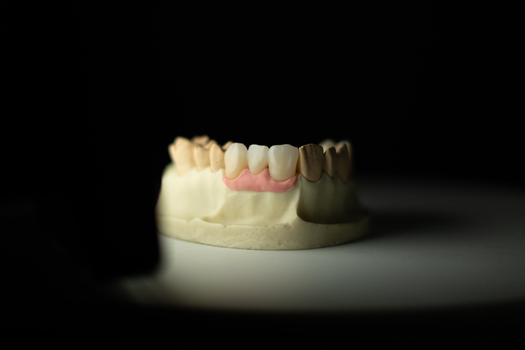 zirconia-1
