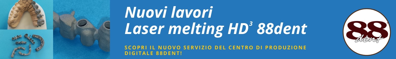 Nuovi lavori Lasermelting 88dent ENG (1656 x 250 px)-Jan-21-2025-11-05-52-0555-AM